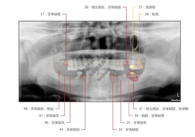 һݵġ족ȫ